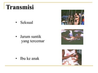 • Seksual
• Jarum suntik
yang tercemar
• Ibu ke anak
Transmisi
 