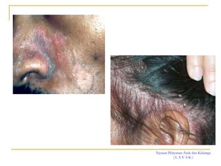 Yayasan Pelayanan Anak dan Keluarga
( L A Y A K )
 