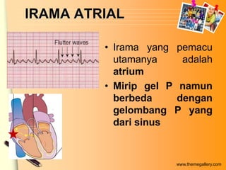 IRAMA ATRIAL

         • Irama yang pemacu
           utamanya     adalah
           atrium
         • Mirip gel P namun
           berbeda     dengan
           gelombang P yang
           dari sinus


                      www.themegallery.com
 