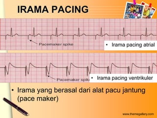 IRAMA PACING


                               • Irama pacing atrial




                         • Irama pacing ventrikuler

• Irama yang berasal dari alat pacu jantung
  (pace maker)

                                      www.themegallery.com
 