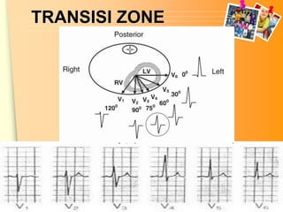 TRANSISI ZONE




                www.themegallery.com
 