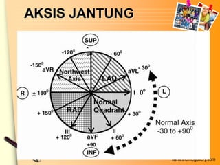 AKSIS JANTUNG




                www.themegallery.com
 