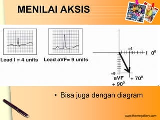 MENILAI AKSIS




      • Bisa juga dengan diagram

                          www.themegallery.com
 