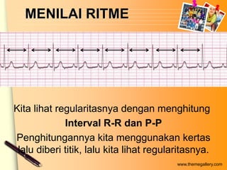 MENILAI RITME




Kita lihat regularitasnya dengan menghitung
             Interval R-R dan P-P
Penghitungannya kita menggunakan kertas
 lalu diberi titik, lalu kita lihat regularitasnya.
                                          www.themegallery.com
 