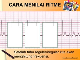 CARA MENILAI RITME




 Setelah tahu reguler/ireguler kita akan
 menghitung frekuensi.           www.themegallery.com
 