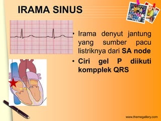 IRAMA SINUS

         • Irama denyut jantung
           yang sumber pacu
           listriknya dari SA node
         • Ciri gel P diikuti
           kompplek QRS




                         www.themegallery.com
 