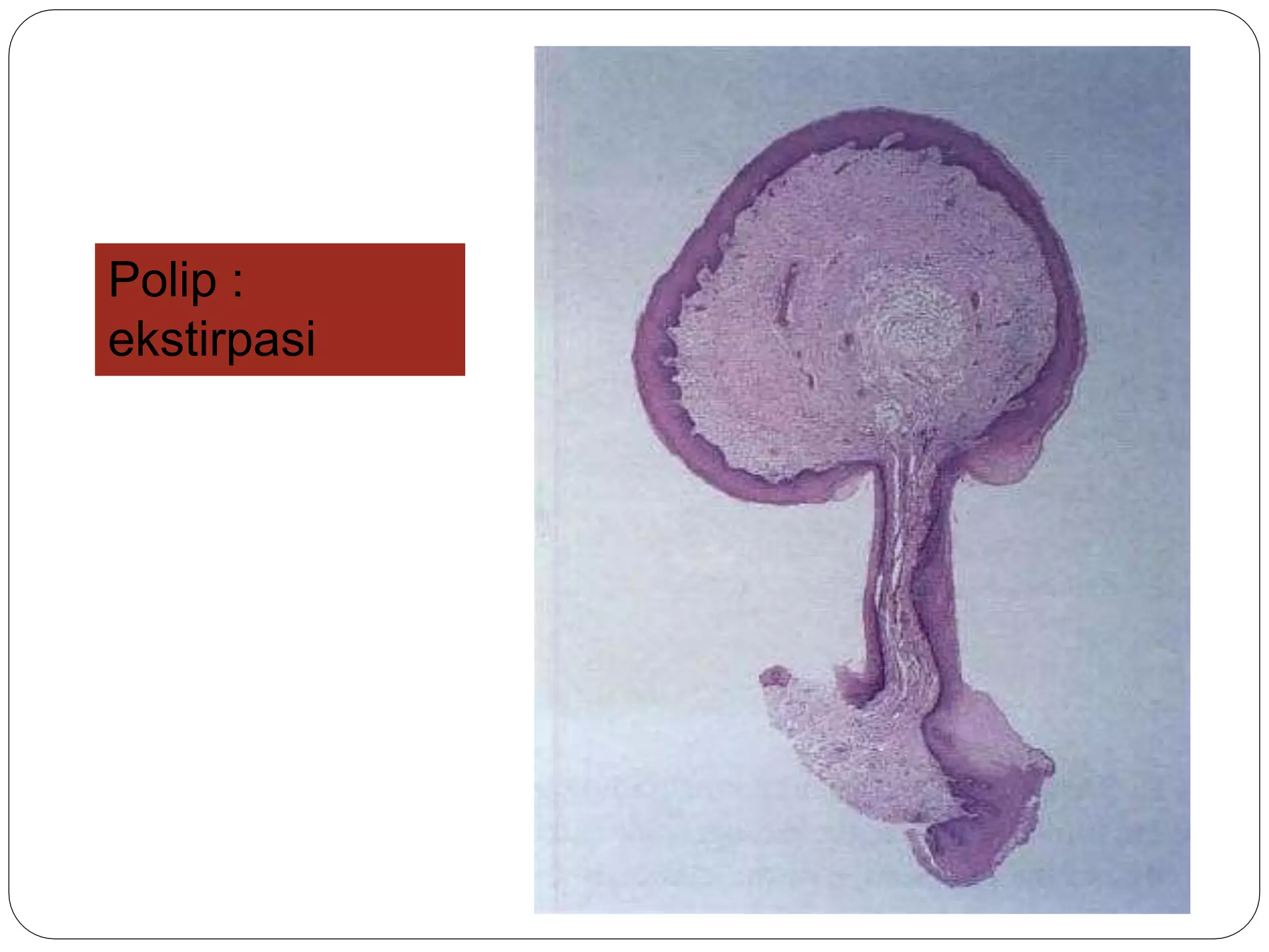 Dasar Pemeriksaan Histopatologi (Biopsi) dan Imunohistokimia (kelompok ...