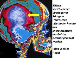 Mittels verschiedener überlagerter Röntgen-Floureszenz -Methoden konnte das Energiezentrum  des Geistes sichtbar gemacht werden. (Blau-Weißer Fleck ) 