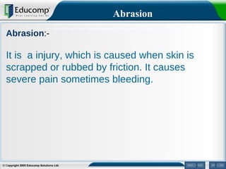 Prevention and management of sports injury | PPT