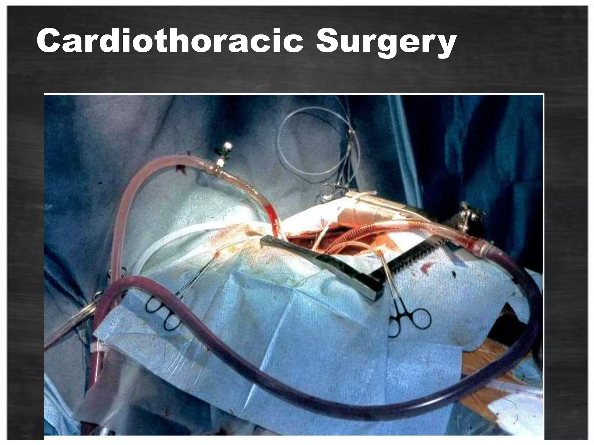Terminology – Adv.LUN - Logical Unit NumberHost - The Server or Servers a LUN is presented to.Disk - How the OS sees a LUN when presentedIOps  - Physical Operation To DiskSequential IO - Reads or writes which are sequential on the spindleRandom IO - Reads or writes which are located at random positions on the spindle