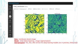 Data: membrane dicom image
Model : Unet (deep learning , image segmentation)
Operationalize: Yes, ACI, AKS service for deep leaning models are in preview, check back
 