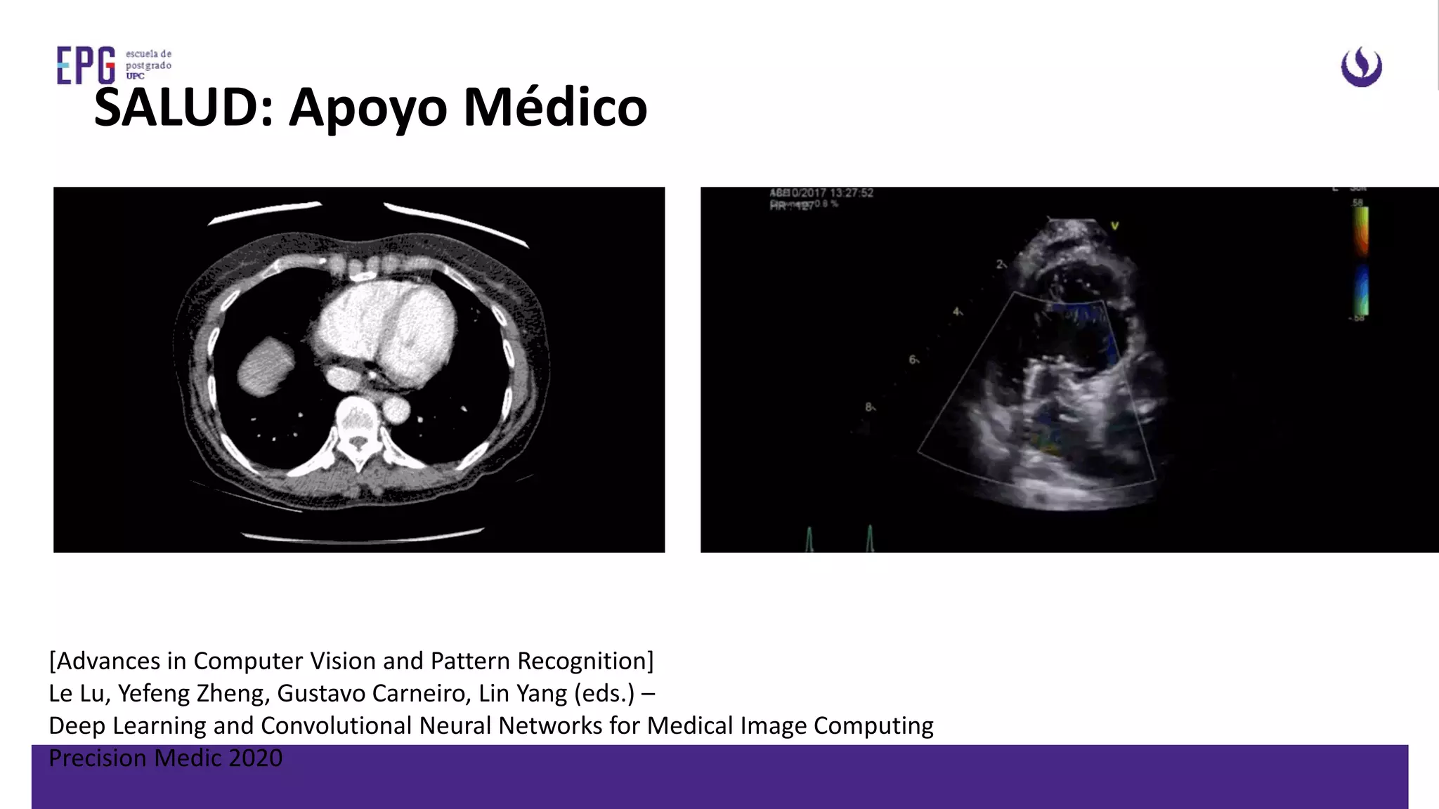 [Advances in Computer Vision and Pattern Recognition]
Le Lu, Yefeng Zheng, Gustavo Carneiro, Lin Yang (eds.) –
Deep Learning and Convolutional Neural Networks for Medical Image Computing
Precision Medic 2020
SALUD: Apoyo Médico
 