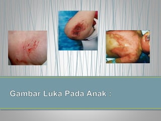 Datia indira putri pgpaud 2012+tugas komputer | PPT