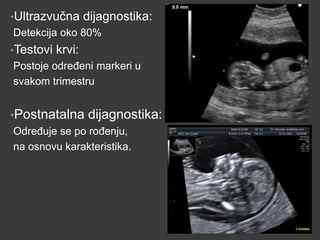 •Ultrazvučna

dijagnostika:

Detekcija oko 80%
•Testovi

krvi:

Postoje odreĎeni markeri u
svakom trimestru
•Postnatalna dijagnostika:
OdreĎuje se po roĎenju,
na osnovu karakteristika.

 