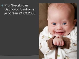 

Prvi Svetski dan
Daunovog Sindroma
je odrţan 21.03.2006

 
