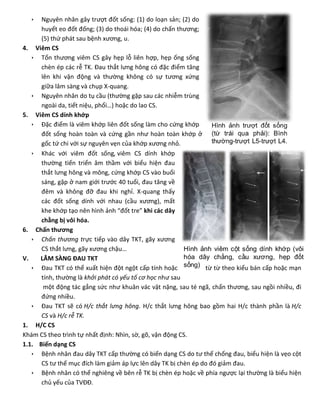  Nguyên nhân gây trượt đốt sống: (1) do loạn sản; (2) do
huyết eo đốt đống; (3) do thoái hóa; (4) do chấn thương;
(5) thứ phát sau bệnh xương, u.
4. Viêm CS
 Tổn thương viêm CS gây hẹp lỗ liên hợp, hẹp ống sống
chèn ép các rễ TK. Đau thắt lưng hông có đặc điểm tăng
lên khi vận động và thường không có sự tương xứng
giữa lâm sàng và chụp X-quang.
 Nguyên nhân do tụ cầu (thường gặp sau các nhiễm trùng
ngoài da, tiết niệu, phổi…) hoặc do lao CS.
5. Viêm CS dính khớp
 Đặc điểm là viêm khớp liên đốt sống làm cho cứng khớp
đốt sống hoàn toàn và cứng gần như hoàn toàn khớp ở
gốc tứ chi với sự nguyên vẹn của khớp xương nhỏ.
 Khác với viêm đốt sống, viêm CS dính khớp
thường tiến triển âm thầm với biểu hiện đau
thắt lưng hông và mông, cứng khớp CS vào buổi
sáng, gặp ở nam giới trước 40 tuổi, đau tăng về
đêm và không đỡ đau khi nghỉ. X-quang thấy
các đốt sống dính với nhau (cầu xương), mất
khe khớp tạo nên hình ảnh “đốt tre” khi các dây
chằng bị vôi hóa.
6. Chấn thương
 Chấn thương trực tiếp vào dây TKT, gãy xương
CS thắt lưng, gãy xương chậu…
V. LÂM SÀNG ĐAU TKT
 Đau TKT có thể xuất hiện đột ngột cấp tính hoặc từ từ theo kiểu bán cấp hoặc mạn
tính, thường là khởi phát có yếu tố cơ học như sau
một động tác gắng sức như khuân vác vật nặng, sau té ngã, chấn thương, sau ngồi nhiều, đi
đứng nhiều.
 Đau TKT sẽ có H/c thắt lưng hông. H/c thắt lưng hông bao gồm hai H/c thành phần là H/c
CS và H/c rễ TK.
1. H/C CS
Khám CS theo trình tự nhất định: Nhìn, sờ, gõ, vận động CS.
1.1. Biến dạng CS
 Bệnh nhân đau dây TKT cấp thường có biến dạng CS do tư thế chống đau, biểu hiện là vẹo cột
CS tư thế mục đích làm giảm áp lực lên dây TK bị chèn ép do đó giảm đau.
 Bệnh nhân có thể nghiêng về bên rễ TK bị chèn ép hoặc về phía ngược lại thường là biểu hiện
chủ yếu của TVĐĐ.
 