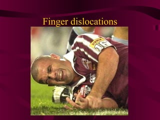 Finger dislocations
 