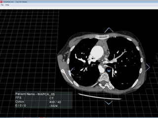2D CT Scan

 
