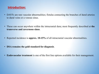 Comprehensive Overview of Intracranial Dural Arteriovenous Fistulas ...