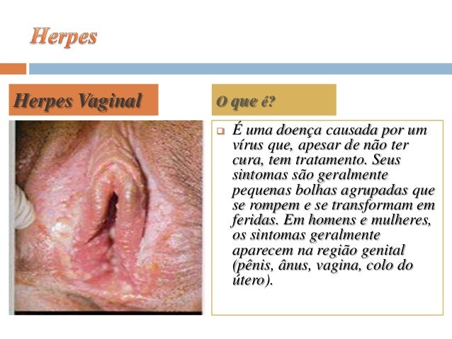 Os g aumentam no membro