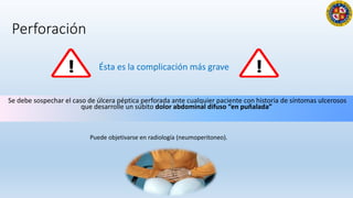 Perforación
Se debe sospechar el caso de úlcera péptica perforada ante cualquier paciente con historia de síntomas ulcerosos
que desarrolle un súbito dolor abdominal difuso “en puñalada”
Ésta es la complicación más grave
12
Puede objetivarse en radiología (neumoperitoneo).
 