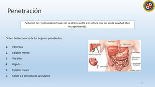 Penetración
Orden de frecuencia de los órganos penetrados:
1. Páncreas
2. Epiplón menor
3. Vía biliar
4. Hígado
5. Epiplón mayor
6. Colon y a estructuras vasculares.
16
Solución de continuidad a través de la úlcera a otra estructura que no sea la cavidad libre
intraperitoneal.
 