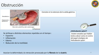 Obstrucción
Consiste en la estenosis de la salida gástrica.
20
Se atribuye a distintos elementos repetidos en el tiempo :
• Espasmo
• Inflamación
• Edema
• Reducción de la motilidad.
Asocian la deformidad y la retracción provocada por la fibrosis de la cicatriz.
¿Helicobacter pylori?
Existen estudios que hablan
tanto a favor como en contra
del papel etiológico de
Helicobacter pylori
 