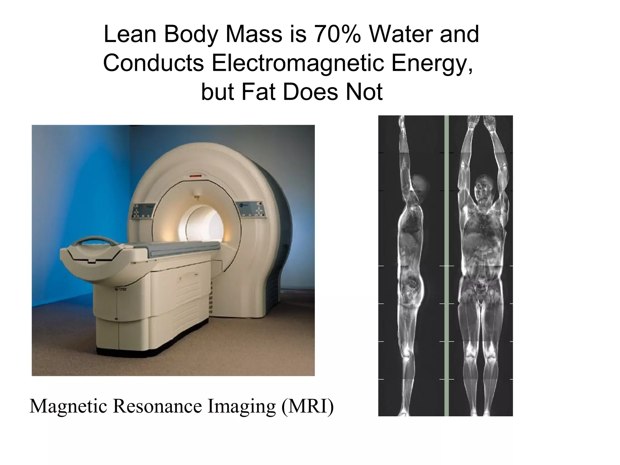 Lean Body Mass is 70% Water and
Conducts Electromagnetic Energy,
but Fat Does Not
Magnetic Resonance Imaging (MRI)
 