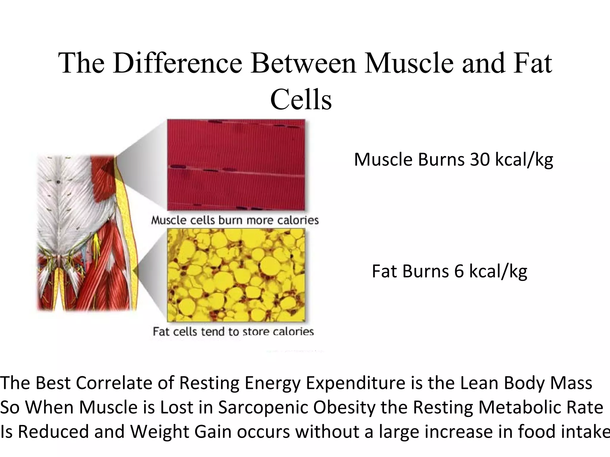 The Difference Between Muscle and Fat
Cells
Muscle Burns 30 kcal/kg
Fat Burns 6 kcal/kg
The Best Correlate of Resting Energy Expenditure is the Lean Body Mass
So When Muscle is Lost in Sarcopenic Obesity the Resting Metabolic Rate
Is Reduced and Weight Gain occurs without a large increase in food intake
 
