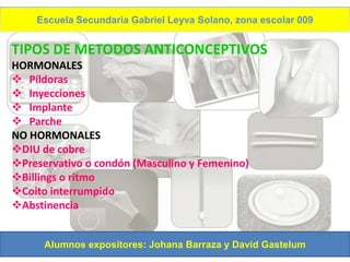 Escuela Secundaria Gabriel Leyva Solano, zona escolar 009


TIPOS DE METODOS ANTICONCEPTIVOS
HORMONALES
 Píldoras
 Inyecciones
 Implante
 Parche
NO HORMONALES
DIU de cobre
Preservativo o condón (Masculino y Femenino)
Billings o ritmo
Coito interrumpido
Abstinencia


      Alumnos expositores: Johana Barraza y David Gastelum
 
