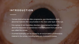 I N T R O D U C T I O N
• Corneal dystrophies are often progressive, eye disorders in which
abnormal material often accumulates in the clear outer layer of the eye.
• It is a group of rare hereditary disorders characterized by bilateral
abnormal deposition of substances in the transparent front part of the
eye called the cornea.
• A corneal dystrophy can be caused by an accumulation of extraneous
material in the cornea, including lipids and cholesterol crystals.
 