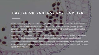 P O S T E R I O R C O R N E A L D Y S T R O P H I E S
• Fuchs corneal dystrophy presents during the fifth or sixth decade of life. The characteristic
clinical findings are excrescences on a thickened Descemet membrane (cornea guttae),
generalized corneal edema and decreased visual acuity. In advanced cases, abnormalities
are found in all the layers of the cornea.
• In posterior polymorphous corneal dystrophy small vesicles appear at the level of Descemet
membrane. Most patients remain asymptomatic and corneal edema is usually absent.
• Congenital hereditary endothelial corneal dystrophy is characterized by a diffuse ground-glass
appearance of both corneas and markedly thickened (2–3 times thicker than normal) corneas
from birth or infancy.
 