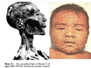 The power of vaccines