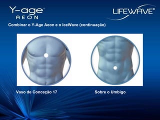 Combinar o Y-Age Aeon e o IceWave (continuação)‏ Vaso de Conceção 17   Sobre o Umbigo 