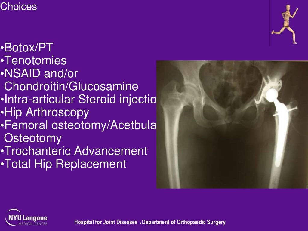 The Hip Joint in Cerebral Palsy David S. Feldman, MD