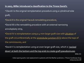 In 2003, Miller introduced a classification to the Tirone David's
• David-I is the original reimplantation procedure using a cylindrical tube
graft,
•David-II is the original Yacoub remodeling procedure,
•David-III is the remodeling procedure with an external narrowing
annuloplasty strip,
•David-IV is reimplantation using a 4-mm larger graft size with plication of
the graft circumferentially at the sinotubular junction (STJ) above the tops of
the commissures, and
•David-V is reimplantation using an even larger graft size, which is ‘necked
down’ at both the bottom and the top ends to create graft pseudosinuses
Miller DC
. Valve-sparing aortic root replacement in patients with the Marfan syndrome. J Thorac Cardiovasc Surg
2003;125:773-778
 
