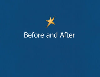 Before and After 