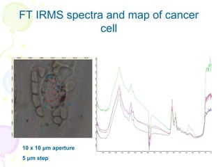 Morphological and Spectral Markers of Cervical Cancer Cells | PPT