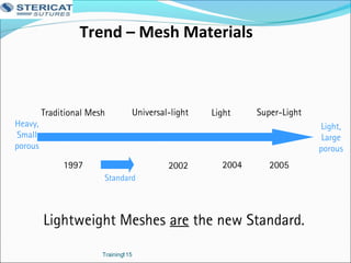 Trend – Mesh Materials
Training115
Standard
Super-LightLightUniversal-lightTraditional Mesh
1997 2002 20052004
Light,
Large
porous
Heavy,
Small
porous
Lightweight Meshes are the new Standard.
 
