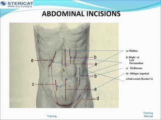 Training
Training
Manual
a) Midline
b) Right or
Left
Paramedian
c) McBurnny
d) Oblique inguinal
e)Sub-costal (Kocher’s)
 