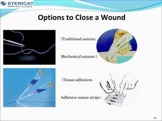 Options to Close a Wound
 Traditional sutures
 Mechanical sutures 
 Tissue adhesives
 Adhesive suture strips 
48
 