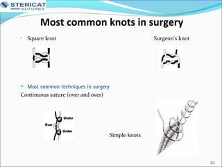 Most common knots in surgery
• Square knot Surgeon's knot
• Most common techniques in surgery
Continuous suture (over and over)
Simple knots
53
 
