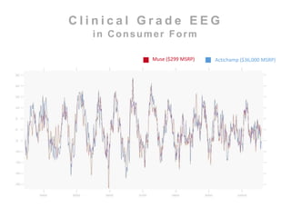 C l i n i c a l G r a d e E E G 
in Consumer Form 
Muse ($299 MSRP) Actichamp ($36,000 MSRP) 
 