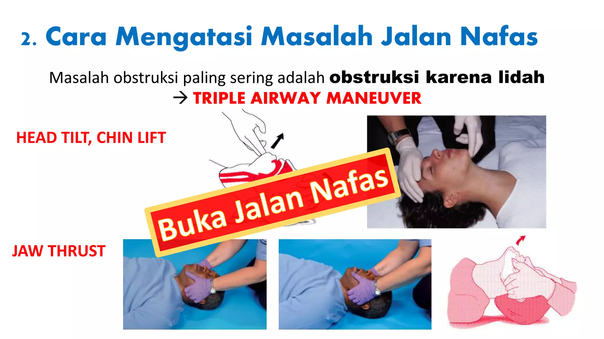 Day 2 Airway Management.pptx