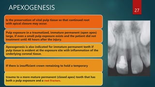APEXOGENESIS
Is the preservation of vital pulp tissue so that continued root
with apical closure may occur.
Pulp exposure ...