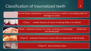 Classification of traumatized teeth
Ellis and Davey classification of crown fracture is useful in recording extent of
dama...