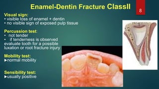 Enamel-Dentin Fracture ClassII
Visual sign:
• visible loss of enamel + dentin
• no visible sign of exposed pulp tissue
Per...