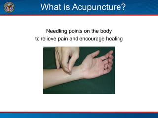 What is Acupuncture?
Needling points on the body
to relieve pain and encourage healing
 