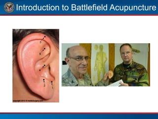Introduction to Battlefield Acupuncture
 