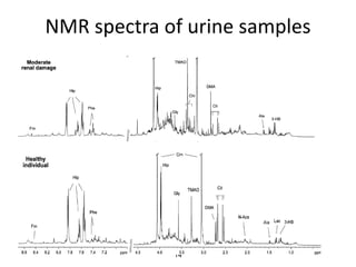 NMR spectra of urine samples




             14
 
